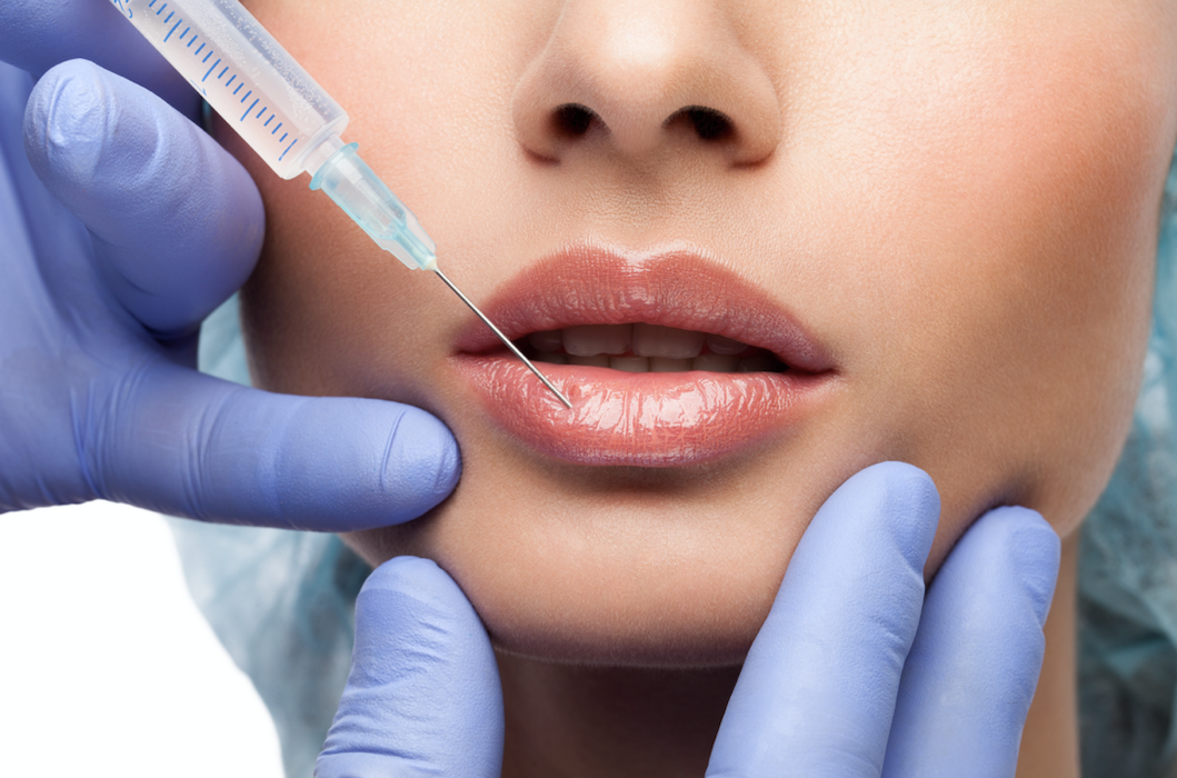 A woman getting injected in the bottom lip