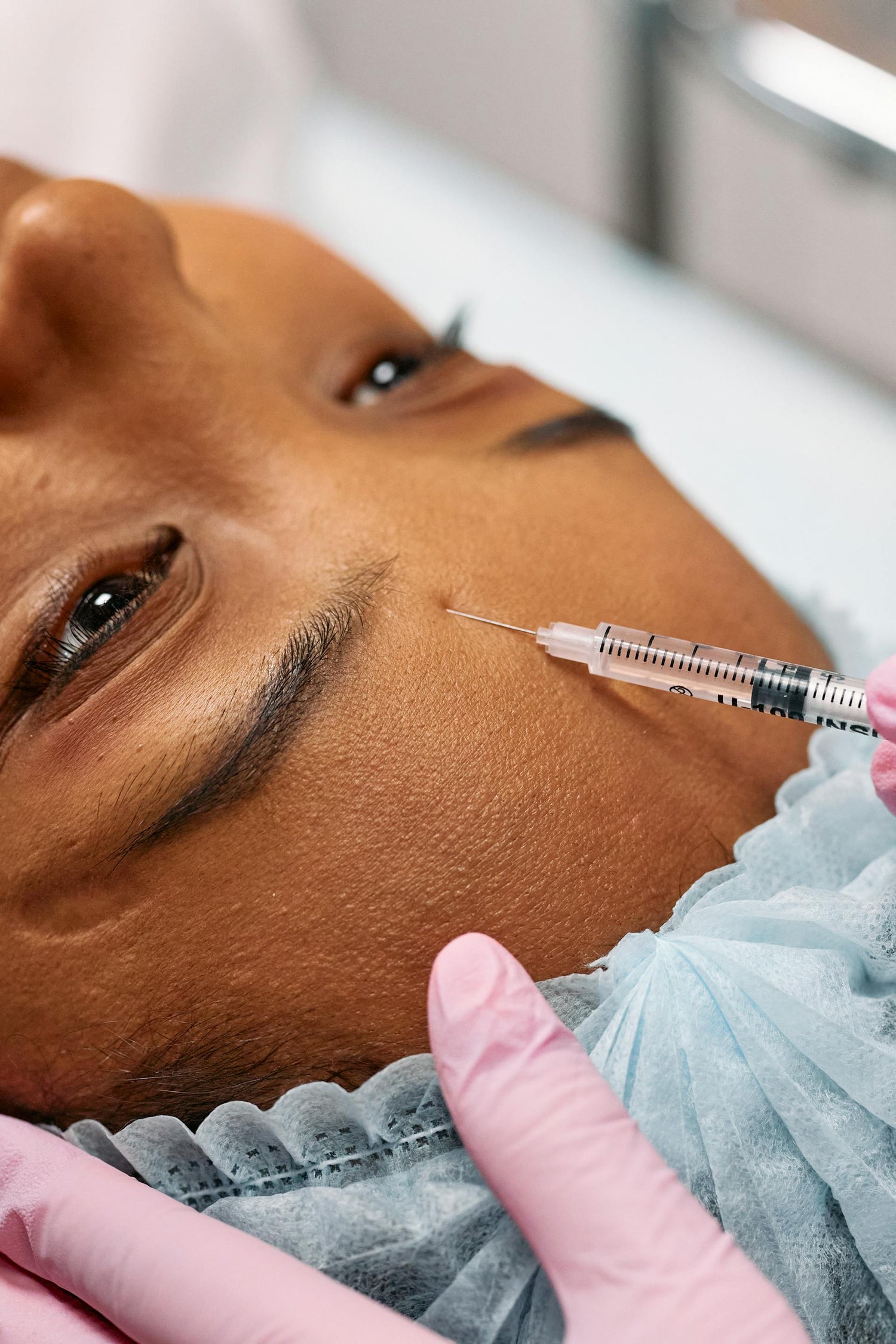 a woman receiving mesotherapy injection in the forehead