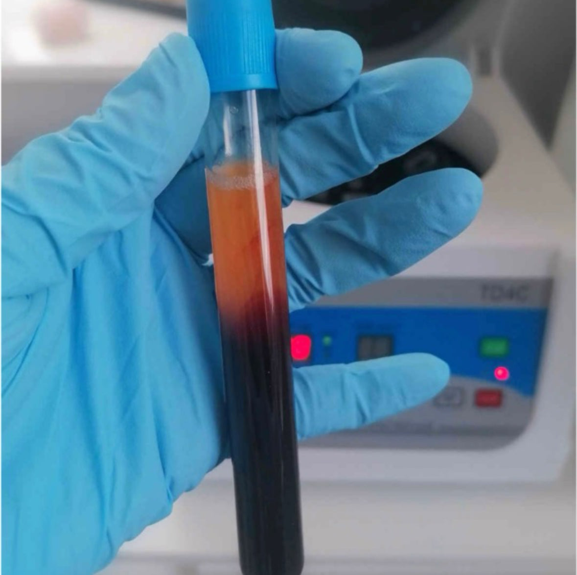 a tube of plasma and blood for I-PRF treatment