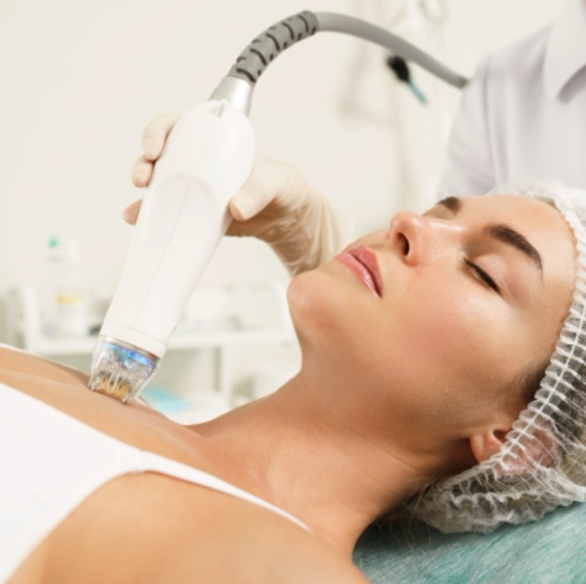 A woman receiving RF needling treatment